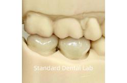 China Dental Lab Crowns Translucent Full Contour Zirconia With Superior Strength supplier