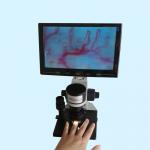 Professional Nailfold Microcirculation Microscope / Nail Checking Microscopes for sale