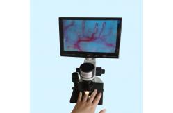 China LCD Display Colour Microcirculation Test Machine Clinical Hospital Home supplier