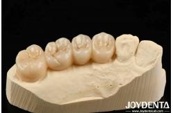 China Multilayer Full Zirconia White Style With Layers High Translucency High Resistance To Cracking supplier