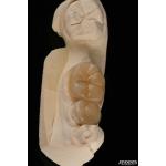 Emax Dental Inlays And Onlays Fracture Resistant 1.5mm Low Translucency for sale