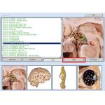 Automatic NLS Vector Bioresonance Health Diagnostic and Test Machine For Villas And Offices for sale