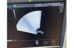 China GE Voluson E8 Ultrasound Machine Repair Image Abnormal When Probe Switched supplier