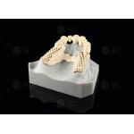 Milled Peek Framework Customizable Digital Partial Dentures Superior Thin for sale