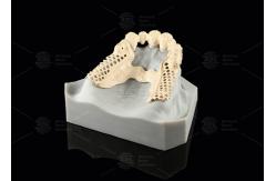 China Milled Peek Framework Customizable Digital Partial Dentures Superior Thin supplier