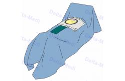China Sterile Surgical C Section Drape With Fenestration Obsterics Gynecology Drape Pack supplier