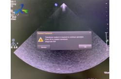 China  EPIQ 5 Ultrasound Machine Repair Startup Report Error 511 Replace ACQ supplier