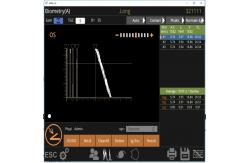China Fan Scan B Scan Machine 10MHz Observing Retinal Detachment supplier