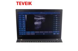 China Medical Ultrasound Instruments USB Protbble Ultrasound Linear Probe supplier