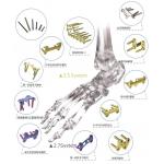 Orthopedic Implant Bone Fracture Titanium Locking Plate For Hands Foot for sale