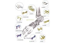 China Orthopedic Implant Bone Fracture Titanium Locking Plate For Hands Foot supplier