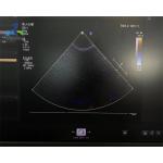  S5-1 Linear Array Ultrasound Transducer Probe Crystal Array Replacement