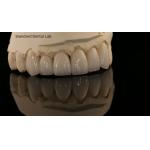 Full Contour Zirconia Crown and High Aesthetic Natural Dental Bridge 5 Year Guarantee for sale