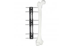 China Pediatric LRS system orthofix Limb Lengthening External Fixator supplier