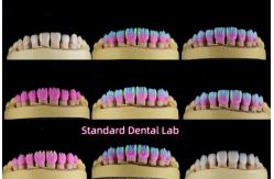 China Dental PFM Crown manufacturer