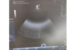 China GE Logiq E Ultrasound Probe Repair 9L-RS Linear Array Transducer Hospital supplier