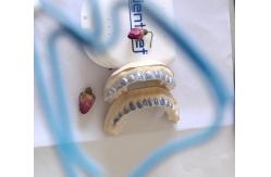 China Custom ISO13485 Bleaching Tray For Whitening Teeth supplier