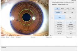 China Portable CE Handheld Eye Iris Scanner Analyzer For Health Detect supplier