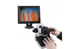 China Blood Capillary Microcirculation Microscope 600X Magnification DC12V 2A Output supplier