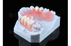 China Natural Looking Valplast Partial Denture Longevity Highly Resistant To Fractures supplier