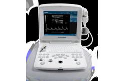 China DUS 60 new compact ultrasound system supplier