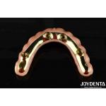 Comfortable To Wear Ti-Bar Restores Chewing Function Essential Ti-Bar Zirconia Hybrid Bridge For B2B Transactions for sale