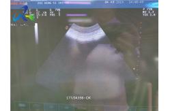 China Esoate CA431 GYN Convex Ultrasound Transducer , Convex Probe Ultrasound For Patient supplier
