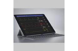 China Veterinary Spo2 Monitor With Internal Memory And Bluetooth Data Transfer supplier