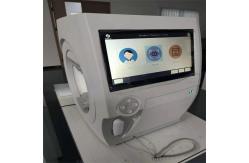 China Glaucoma Vision Field Test Machine , Computerized Peripheral Vision Test Equipment supplier