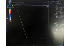 China GE 12L-RS Ultrasound Probe Repair For Crystal Array Replacement supplier