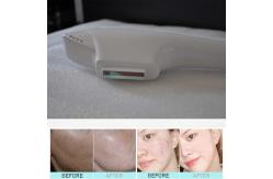 China qmmadical 2 in 1 IPL + diode laser Hair Removal beauty machine supplier