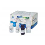 Sperm DNA fragmentation test sperm chromatin structure assay SCSA for sale
