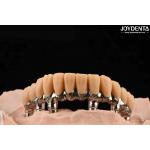 China Yellow Resin Temporary Teeth Smooth Surface Treatment Precise And Stable manufacturer