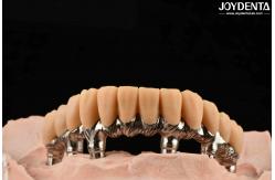 China Yellow Resin Temporary Teeth Smooth Surface Treatment Precise And Stable supplier