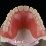 Dental Temporary Acrylic Partial Denture Ivoclar YAMAHACHI for sale