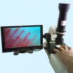 Magnification 400 Times Microcirculation Microscope Multi-Function Medical Instrument for sale