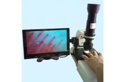 China Hospital Nailfold Capillary Microscopy /  Microcirculation Microscope Multi Function for Medical supplier