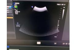 China  EPIQ 5 Ultrasound Machine Repair Startup Report Error 511 Replace ACQ supplier