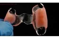China Flexible Clear Metal Cast Framework Partial Dentures High Esthetics Perfect Fit supplier