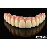 Low Density Light Weight Comfortable To Wear Titanium Malong Hybrid Bridge For Long-Lasting Performance for sale