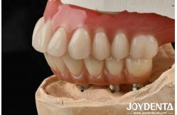 China Good Elasticity Dental Acrylic Denture Finish With Tooth Arrangement Technology supplier
