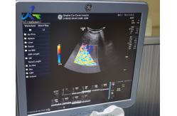 China GE Logiq S8 Image Anomaly Ultrasound Machine Repair Replace Channel Board supplier