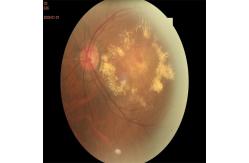 China Automated Retinal Fundus Camera Non Contact High Resolution supplier