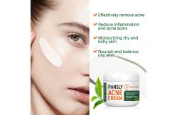 China Moisturizing Anti Aging Acne Scar Removal Cream Tea Tree Skin Care Set supplier