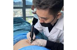 China 15ml Semi Permanent PMU Pigment Skin Remodeling Scars Remove White Freckles Vitiligo supplier