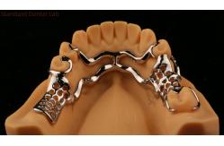 China Upper Cast Metal Framework Partial Dentures Strong Lightweight And Durable supplier