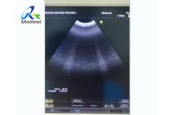 China Aloka Image No Probe Image Ultrasound Machine Repair Cell Board supplier
