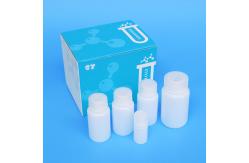 China ISO13485 48mL 60mL DNA Extraction Kits PCR Detection Swab Kit supplier