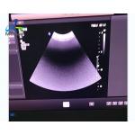 EPIQ 5 Ultrasound Machine Repair Startup Report Error 025 Replace ACQ for sale
