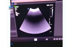 China EPIQ 5 Ultrasound Machine Repair Startup Report Error 025 Replace ACQ supplier